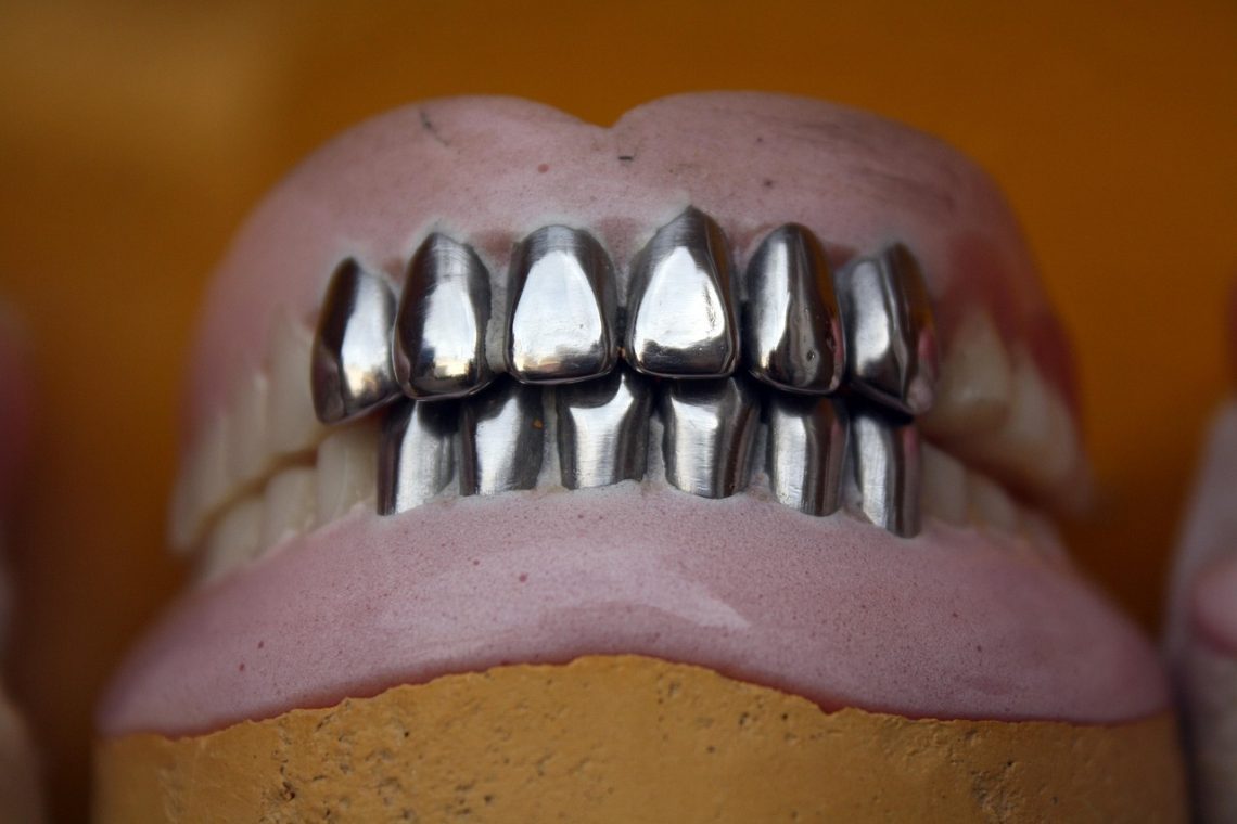 discover the key differences between dental implants and bridges, including benefits, costs, and which option might be best for your dental health.