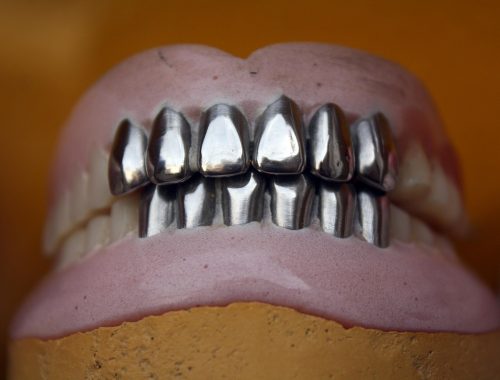 discover the key differences between dental implants and bridges, including benefits, costs, and which option might be best for your dental health.