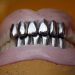 discover the key differences between dental implants and bridges, including benefits, costs, and which option might be best for your dental health.